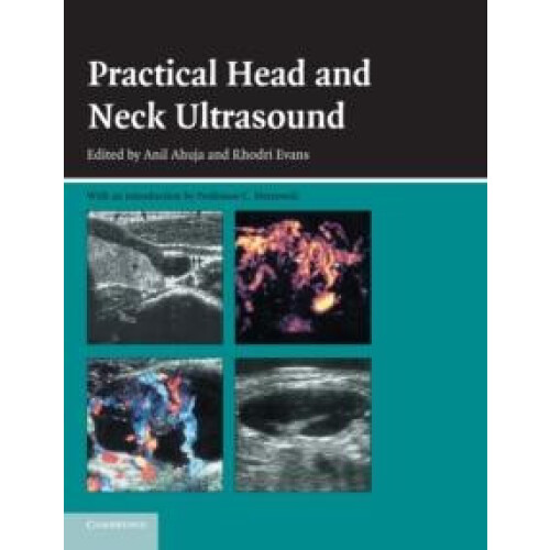 Practical Head Neck Ultrasound Paperback Book