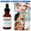Needle-less Serum Renew 1.0 Oz/ 30ml NWOB 6