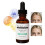 Needle-less Serum Renew 1.0 Oz/ 30ml NWOB 3