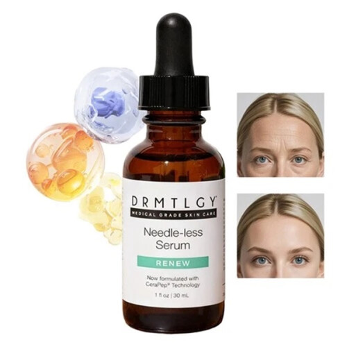 Needle-less Serum Renew 1.0 Oz/ 30ml NWOB 2