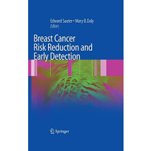 Breast Cancer Risk Reduction and Early Detection Paperback Book