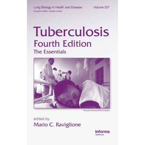 Tuberculosis The Essentials Fourth Edition Hardcover Book