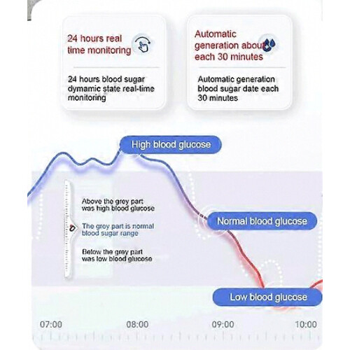 Έξυπνο ρολόι TrackPro 2.0 για άνδρες και γυναίκες, καθημερινό αδιάβροχο B 1