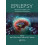 Epilepsy: Mechanisms, Models, and Translational Perspectives 1