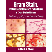 Gram Stain: Looking Beyond Bacteria to Find Fungi in Gram Stained Smear: A laboratory guide for medical microbiology