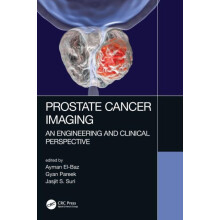 Prostate Cancer Imaging An Engineering and Clinical Perspective Hardco