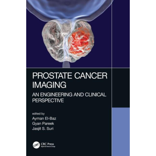 Prostate Cancer Imaging An Engineering and Clinical Perspective Hardco