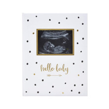First 5 Years Baby Memory Book with Sonogram Photo Insert, Black and Gold Polka Dot, Baby Keepsake Memory Book, Hello Baby Babybook