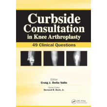 Curbside Consultation in Knee Arthroplasty 49 Clinical Questions Paper
