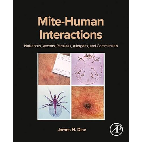MiteHuman Interactions Nuisances Vectors Parasites Allergens and Comme