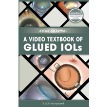 A Video Textbook of Glued IOLs by Amar Agarwal Paperback Book