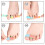 Toe Corrector Bandage Strips - 2 Pcs, Adjustable Toe Separator with Velcro Strap 4