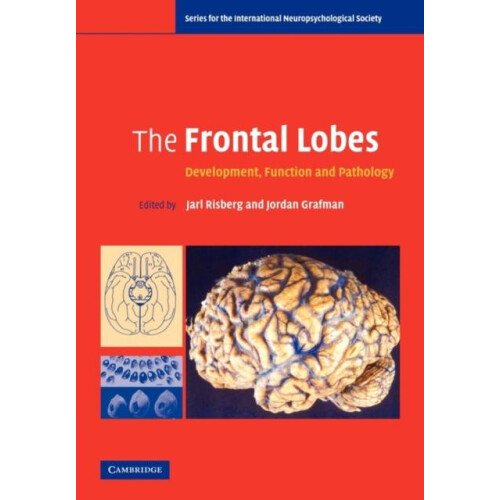 The Frontal Lobes Paperback Book