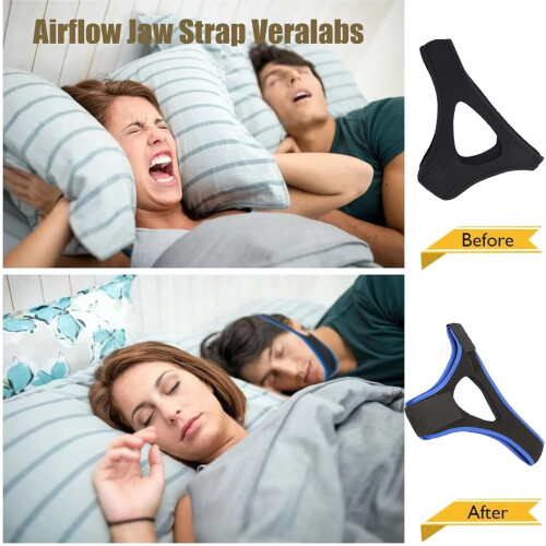 Airflow Jaw Strap for Sleep Apnea Treatment 2