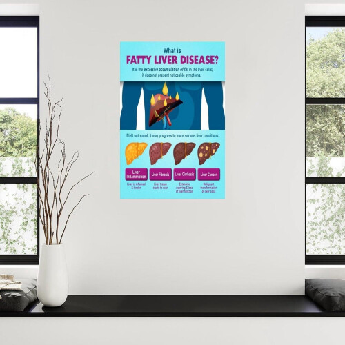 Fatty Liver Disease Chart Poster Canvas Wall Decor 2