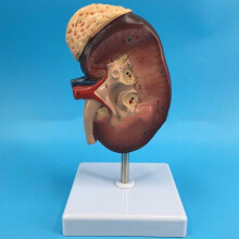 Human Kidney Anatomical Model Enlarged 2X with Accurate