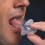 Anti-Snoring Device Silicone Tongue Retainer 1-6 pcs 5