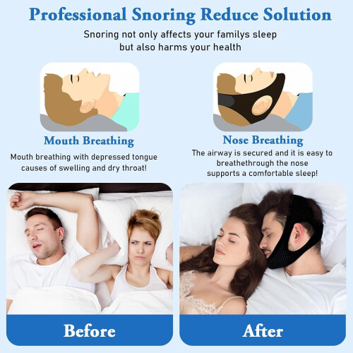 Snoring Stopper Chin Strap 2-Pack for Mouth Breathing 1