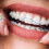 Orthodontic Floss Threaders for Braces Bridges Implants 2