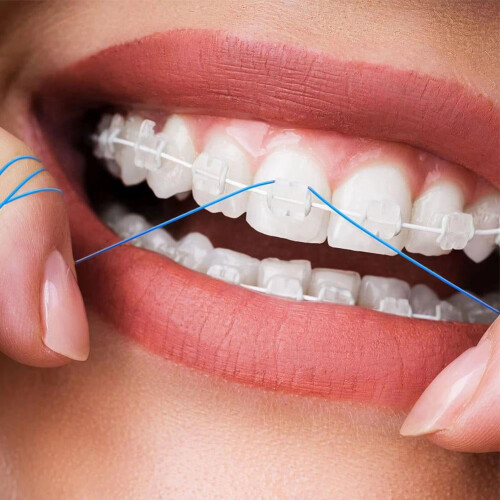 Orthodontic Floss Threaders for Braces Bridges Implants 1
