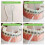 Orthodontic Floss Threaders for Braces Bridges Implants 6