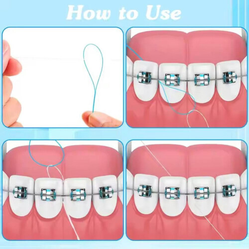Orthodontic Floss Threaders for Braces Bridges Implants 2