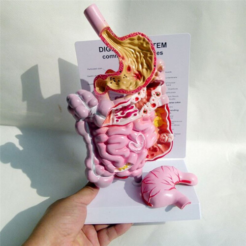 Human Digestive System Model Stomach Anatomy Intestine Cecum Rectum Duodenum Human Internal Organs Structure Model