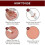 Wipe Off Tags And Mole Remover, Skin Tag Remover Liquid, Effectively Remove Skin Tags -3ml 4