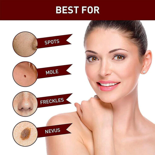Wipe Off Tags And Mole Remover, Skin Tag Remover Liquid, Effectively Remove Skin Tags -3ml 2