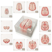 (As show, One size) Dessous de verre en forme de spécimen de cerveau anatomique - Cadeaux pour étudiants en médecine - Décoration