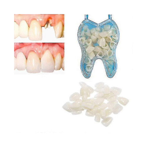 (As show, Back teeth) Tillfällig tandreparationskit Tänder och mellanrum Solid Whitening 1