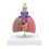 Respiratory Model Life-Size Pathological Lung Anatomy 5