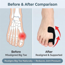 60PCS Pre-Cut Bunion Corrector Kinesiology Tape- Elastic, Breathable & Hypoallergenic