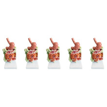 5X Model van Het Menselijk Spijsverteringsstelsel Maaganatomie Dikke Darm Blindedarm Rectum Twaalfvingerige Darm Structuurmodel van Menselijke Interne