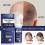 25-26 Regaine for Men Regrowth Scalp Foam 1