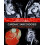 Cardiac Sarcoidosis Paperback Book 1