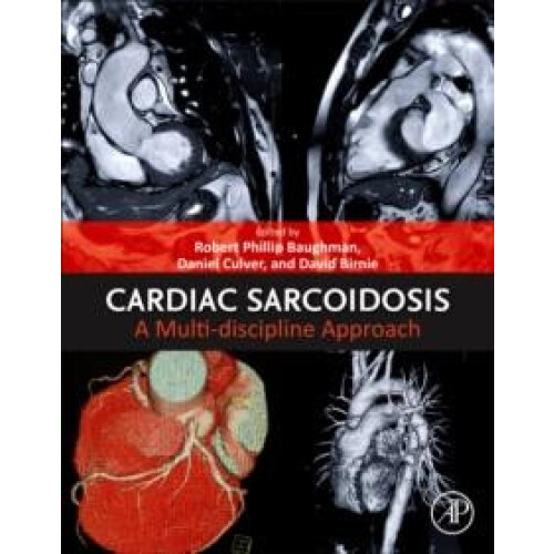 Cardiac Sarcoidosis Paperback Book