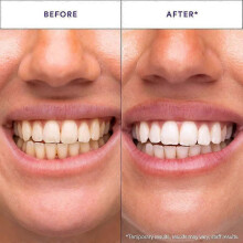 V34 Whitening Strips, Gentle Daily Teeth Cleaning and Care Strips