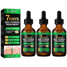(3pcs) Nail Fungus Treatment, Ginger Nail Fungus Treatment, Toenail Cuticle Care Oil Care, Fungal Nail Treatment