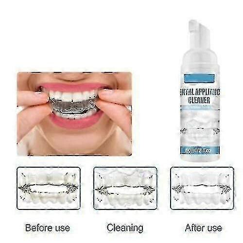 Aligner Foam 60ml, Clean Retainer And Braces, for Care 1