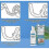 Aligner Foam 60ml, Clean Retainer And Braces, for Care 3