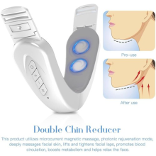 Electric V-Face Shaping Massage Face Lifting Slim Double Chin Removal Machine UK