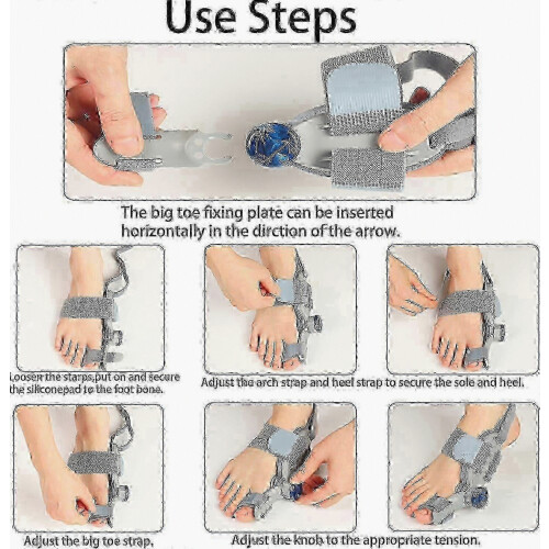 Bunion Corrector for Women and Men, Adjustable Knob Design with Silicone Pad, Comfortable Foot Support 1