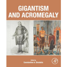 Gigantism and Acromegaly Paperback Book