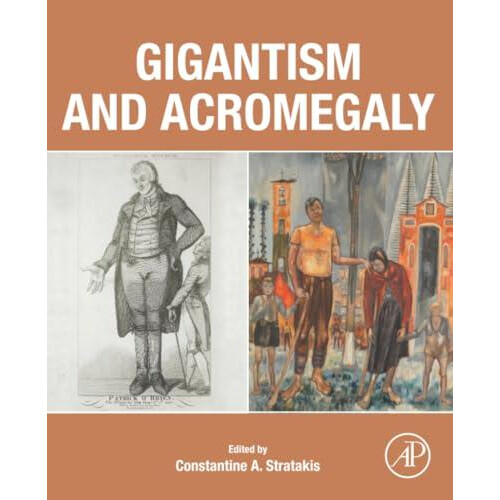 Gigantism and Acromegaly Paperback Book