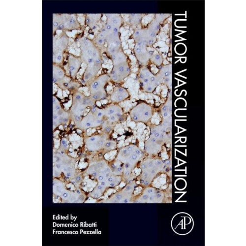 Tumor Vascularization Paperback Book