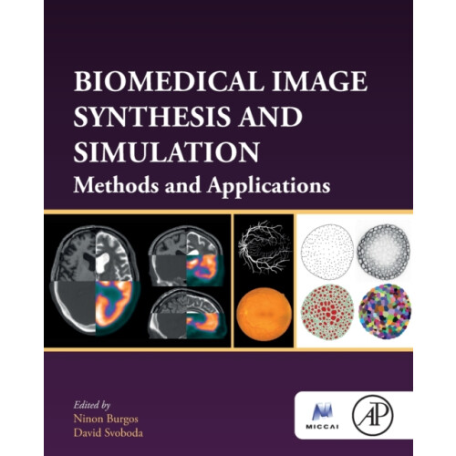 Biomedical Image Synthesis and Simulation Methods and Applications Pap