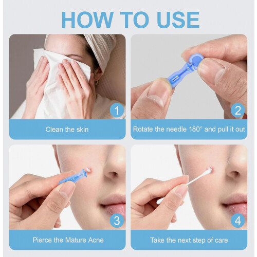 Lot de 100 aiguilles stériles à usage unique pour l'extraction de points noirs et d'acné, adaptées à une utilisation en institut de beauté e 2