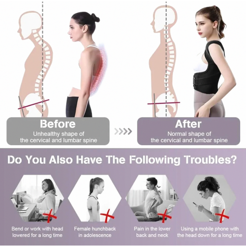 Posture Corrector for Women and Men, Adjustable Back Support, Breathable Shoulder Straps, Back Brace for Upper Back, Nec 2