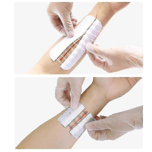 Zipper Band-aid Painless Wound Closure Device - 4/10pcs Pack 1